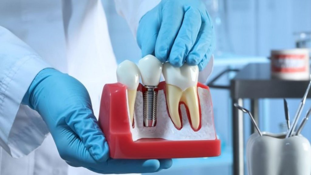 Consiliul Concurentei vizeaza dentistii Ce banuiesc inspectorii
