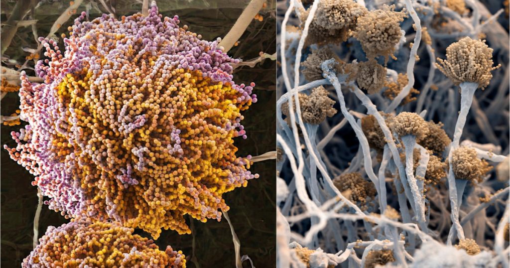 Un nou supermicrob ameninta planeta si se raspandeste
